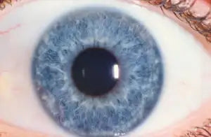 Blue iris contact lens with a gradient effect and textured surface.