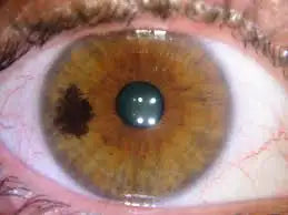 Brown contact lens with greenish-black pupil and gold iris design