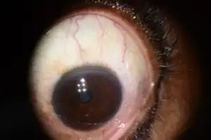 Brown human eye with visible blood vessels and eyelashes.