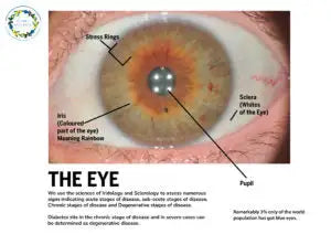 Eye diagram